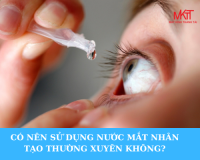 CÓ NÊN SỬ DỤNG NƯỚC MẮT NHÂN TẠO THƯỜNG XUYÊN KHÔNG?